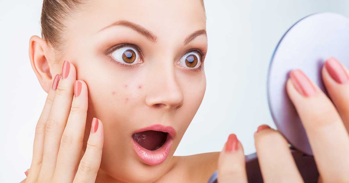 Using colloidal silver to treat acne